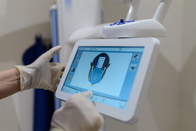 Endodoncia en Ourense tratamos de mantener cualquier pieza dental dañada, evitando recurrir a extracciones